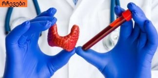 რაც ყველა ქალმა უნდა იცოდეს, ყველაფერი ჰორმონების შესახებ!