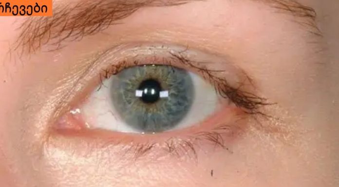 რა განსაზღვრავს წამწამების ჯანმრთელობას,რატო ცვივა წამწამები და როგორ მოვიქცეთ.