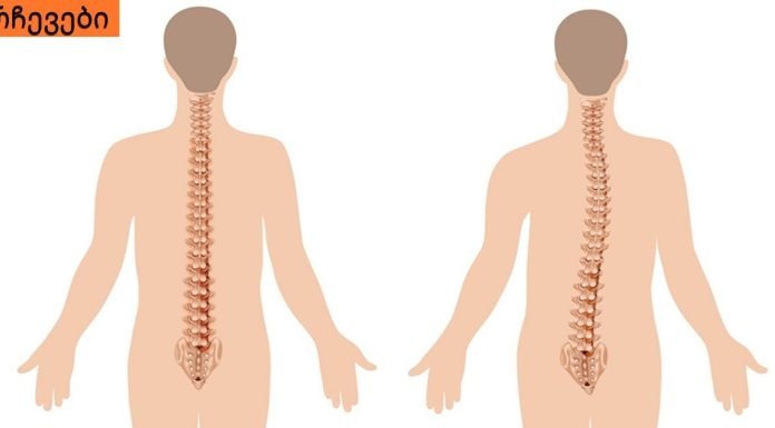 უმარტივესი ვარჯიში, რომელიც ხერხემალს გააჯანსაღებს-ეფექტურია!