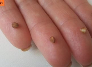 ჰიპერტენზია (წნევა ): როგორ დავეხმაროთ საკუთარ თავს ტაბლეტების გარეშე? სწრაფი და ეფექტური გზა!