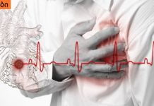 რა განსხვავებაა ინსულტს, გულის უკმარისობასა და ინფარქტს შორის? საჭირო ინფორმაცია!