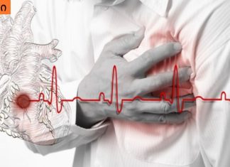 რა განსხვავებაა ინსულტს, გულის უკმარისობასა და ინფარქტს შორის? საჭირო ინფორმაცია!