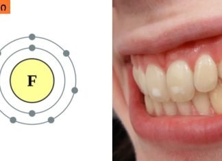 ფტორის მოქმედება სხეულზე,დადებით შედეგებთან ერთად ნახეთ რა უარყოფითი გავლენა აქვს ფტორს ორგანიზმზე.