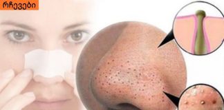 ამ უმარტივესი და ეფექტური ნიღბების დახმარებით, შავ წერტილებს სამუდამოდ მოიშორებთ!