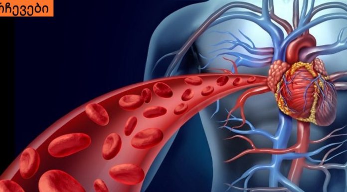 ჯანმრთელობა ლიმფის ეფექტური გაწმენდის შედეგია! ლიმფის გაწმენდის უმარტივესი გზა