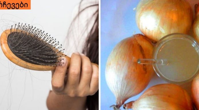 თუ გაწუხებთ ზედმეტი თმის ცვენა, სცადეთ ამ სტატიის ერთ-ერთი რეცეპტი.ძალიან ბედნიერი ვარ , თმა აღარ მცვივა.