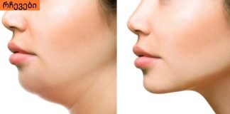 როგორ უნდა მოიშოროთ ღაბაბი? ყველაზე მარტივი და ეფექტური ხერხი რაც აქამდე გსმენიათ