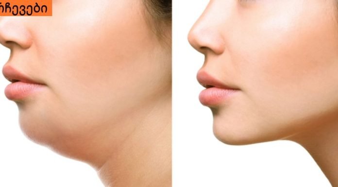 როგორ უნდა მოიშოროთ ღაბაბი? ყველაზე მარტივი და ეფექტური ხერხი რაც აქამდე გსმენიათ