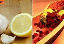 ამ გერმანული მეთოდის დახმარებით შეიმცირებთ ქოლესტერინს და აიმაღლებთ იმუნიტეტს!