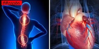 გინდა ჯანმრთელი გული? გაუფრთხილდით ხერხემალს!