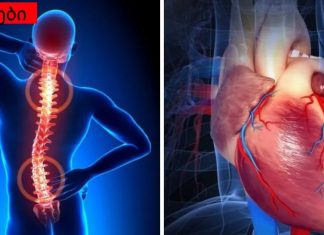 გინდა ჯანმრთელი გული? გაუფრთხილდით ხერხემალს!