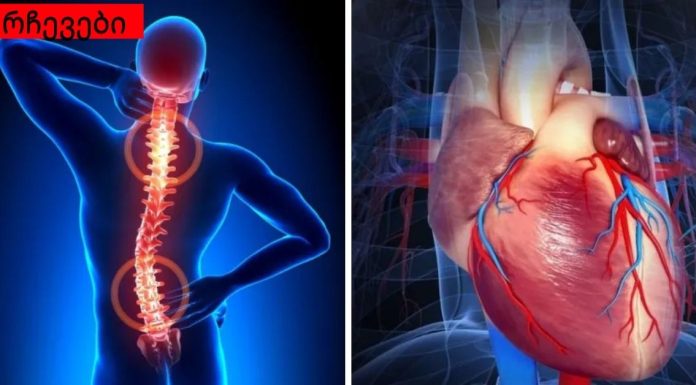 გინდა ჯანმრთელი გული? გაუფრთხილდით ხერხემალს!