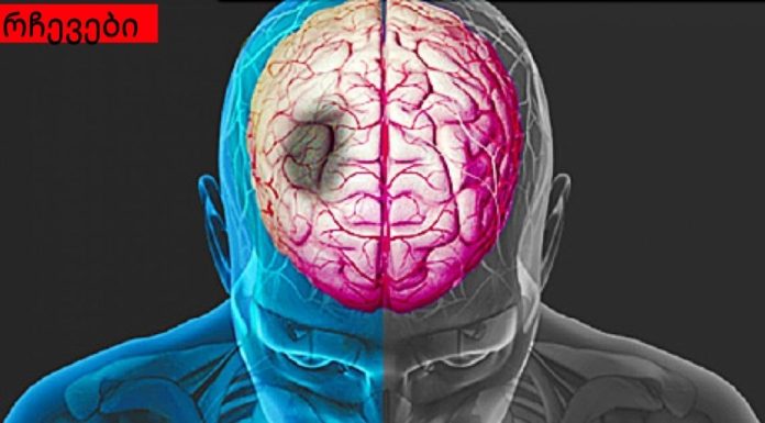 რა მიგანიშნებთ ინსულტზე? ის, რასაც ყველა უნდა დააკვირდეს