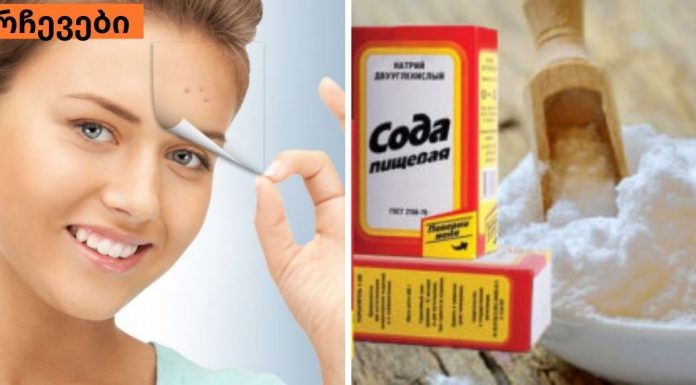 ეს ნიღაბი გამანადგურებელი დარტყმაა შავი წერტილებისთვის!