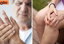 ნაზავი, რომელიც ართრიტს ყველაზე სწრაფად კურნავს. ძალიან ეფექტური მეთოდია