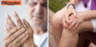 ნაზავი, რომელიც ართრიტს ყველაზე სწრაფად კურნავს. ძალიან ეფექტური მეთოდია