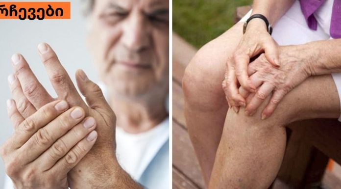 ნაზავი, რომელიც ართრიტს ყველაზე სწრაფად კურნავს. ძალიან ეფექტური მეთოდია