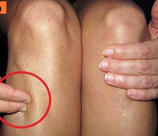 ეს სხეულის უნიკალური წერტილი ასამდე დაავადებას კურნავს. ეს უკვე ბევრმა ადამიანმა სცადა