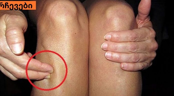 ეს სხეულის უნიკალური წერტილი ასამდე დაავადებას კურნავს. ეს უკვე ბევრმა ადამიანმა სცადა