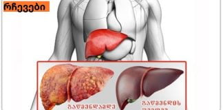 საუკეთესო საშუალება ღვიძლის სამკურნალოდ