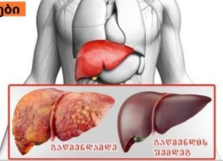 საუკეთესო საშუალება ღვიძლის სამკურნალოდ