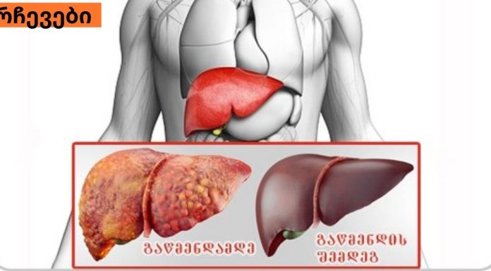 საუკეთესო საშუალება ღვიძლის სამკურნალოდ