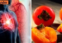 საკვების ჩამონათვალი, რომელიც წმენდს არტერიებს და ხელს უწყობს გულის შეტევის თავიდან აცილებას