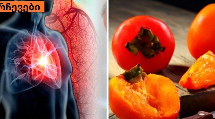 საკვების ჩამონათვალი, რომელიც წმენდს არტერიებს და ხელს უწყობს გულის შეტევის თავიდან აცილებას