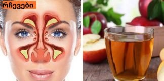 ვაშლის ძმრის რეალური გამოყენება: ყელის და ცხვირის მკურნალობა