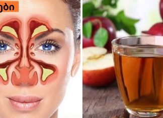 ვაშლის ძმრის რეალური გამოყენება: ყელის და ცხვირის მკურნალობა