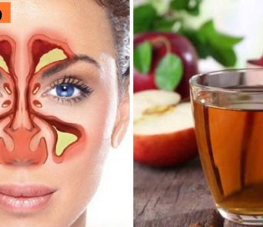 ვაშლის ძმრის რეალური გამოყენება: ყელის და ცხვირის მკურნალობა