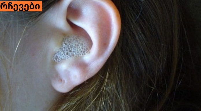 ამ სითხის მხოლოდ 3 წვეთია საჭირო გოგირდის საცობის მოსაშორებლად! ეფექტური საშუალებაა…