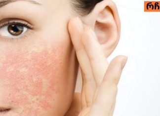 მგრძნობიარე კანის მოვლა