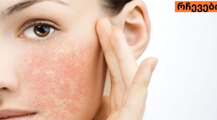 მგრძნობიარე კანის მოვლა