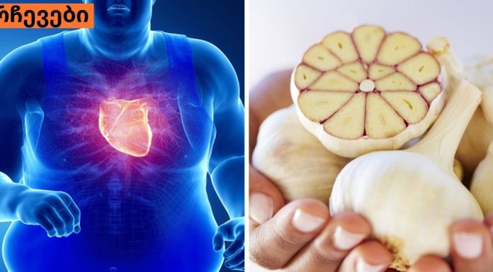 გსმენიათ, რომ ნიორი კარგია გულისთვის? აი, რა უნდა იცოდეთ ამის შესახებ