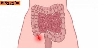 ბავშვებში ბრმა ნაწლავის გამომწვევი მიზეზები ,სიმპტომები ,მკურნალობა.