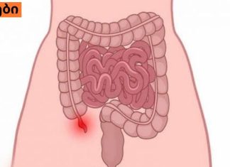 ბავშვებში ბრმა ნაწლავის გამომწვევი მიზეზები ,სიმპტომები ,მკურნალობა.