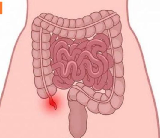 ბავშვებში ბრმა ნაწლავის გამომწვევი მიზეზები ,სიმპტომები ,მკურნალობა.