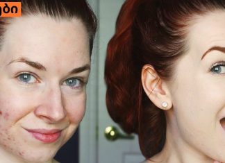 ფერიმჭამელებისგან გათავისუფლების ყველაზე სწრაფი და მარტივი გზა. ეს უკვე ბევრმა სცადა