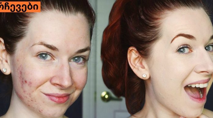 ფერიმჭამელებისგან გათავისუფლების ყველაზე სწრაფი და მარტივი გზა. ეს უკვე ბევრმა სცადა