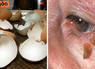 მეჭეჭები ,რომელსაც ვირუსი იწვევს განკურნებადია უმარტივესი მეთოდით,სცადეთ.