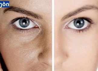 როგორ უნდა გააქროთ ღია ფორები სახეზე? მხოლოდ ერთი ინგრედიენტი და იდეალური შედეგი