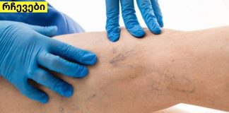 როგორ ვუმკურნალოთ ვენების თრომბოზს ამ ორი ინგრედიენტის დახმარებით? ეფექტურია