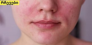 5 ხალხური საშუალება, რომელიც დაგეხმარებათ დერმატიტის განკურნებაში.