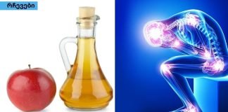 ვაშლის სიდრი ძმარი სახსრების ტკივილისთვის