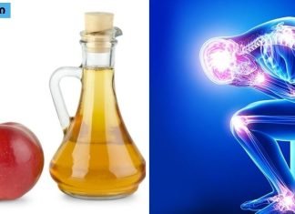 ვაშლის სიდრი ძმარი სახსრების ტკივილისთვის