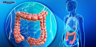 ნაწლავის გაუვალობა – ყველაფერი რაც თქვენ უნდა იცოდეთ ამის შესახებ და საოცარი საშუალებები მის განსაკურნებლად.