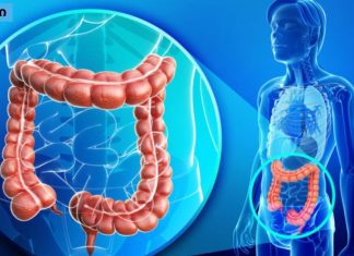 ნაწლავის გაუვალობა – ყველაფერი რაც თქვენ უნდა იცოდეთ ამის შესახებ და საოცარი საშუალებები მის განსაკურნებლად.