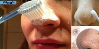 როგორ მოვიშორო შავი წერტილები მთლიანად კბილის პასტით?