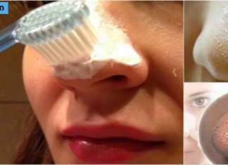 როგორ მოვიშორო შავი წერტილები მთლიანად კბილის პასტით?